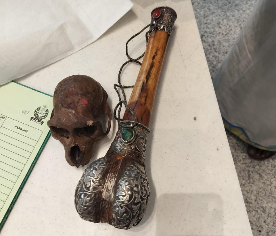 New Delhi: CISF detects skull concealed in passenger’s hand baggage at IGI Airport