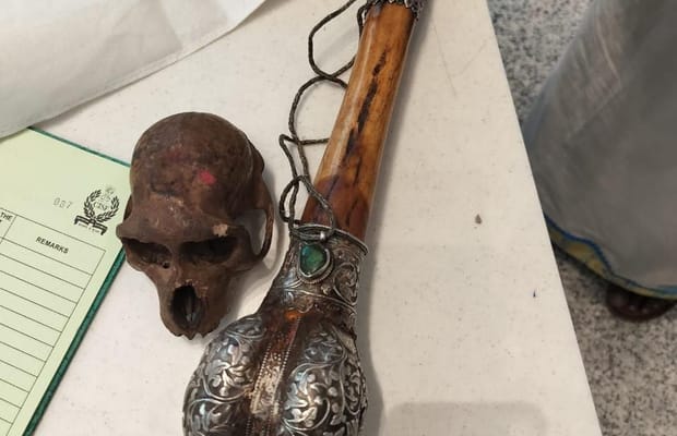 New Delhi: CISF detects skull concealed in passenger’s hand baggage at IGI Airport